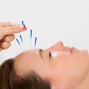 thinkstockphotos-andreypopov-young-woman-receiving-acupuncture-treatment